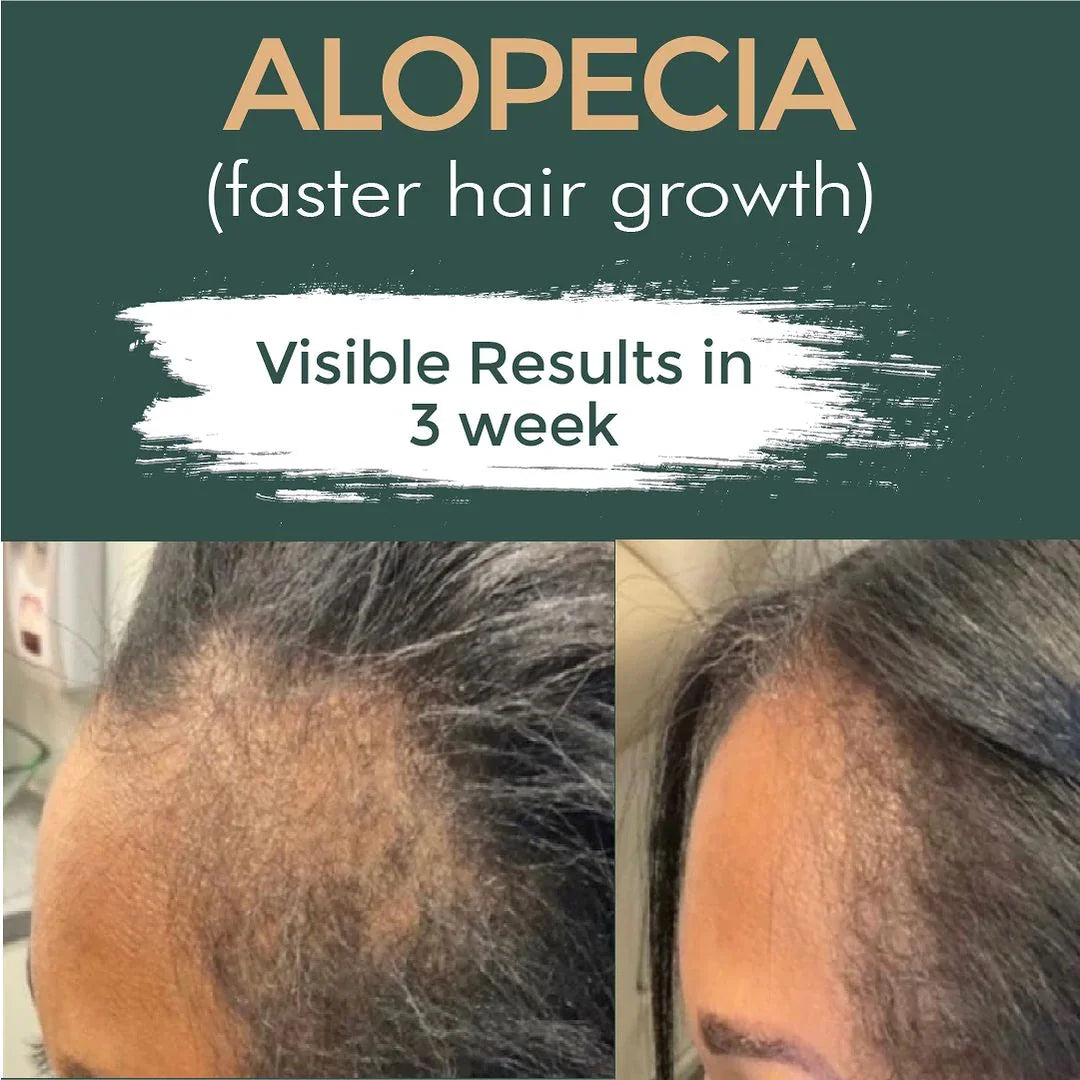 Well Grow Hair Oil - Saif Dawkhana