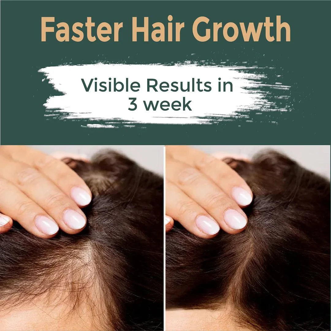 Well Grow Hair Oil - Saif Dawkhana